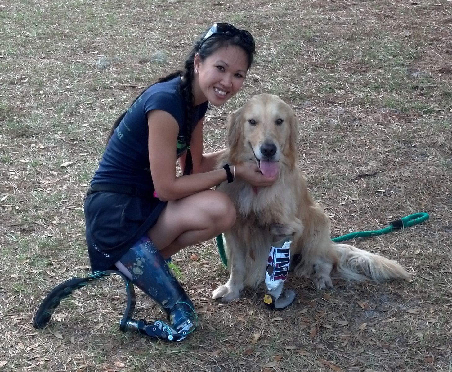 Northern Orthotics & Prosthetics Michigan